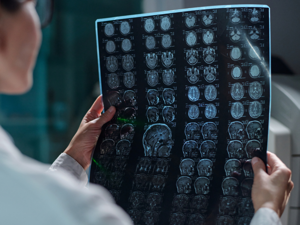 Neurologista: Como a saúde do cérebro impacta sua qualidade de vida